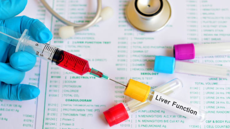 How-to-Read-and-Understand-Liver-Function-Test-2-1024x576-1