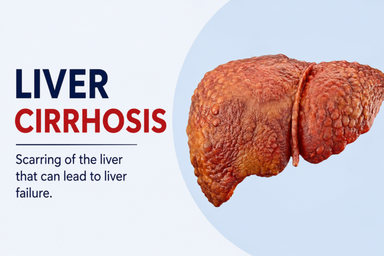 liver-cirrhosis-symptoms-causes-diagnosis-treatment